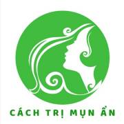 cachtrimunan1